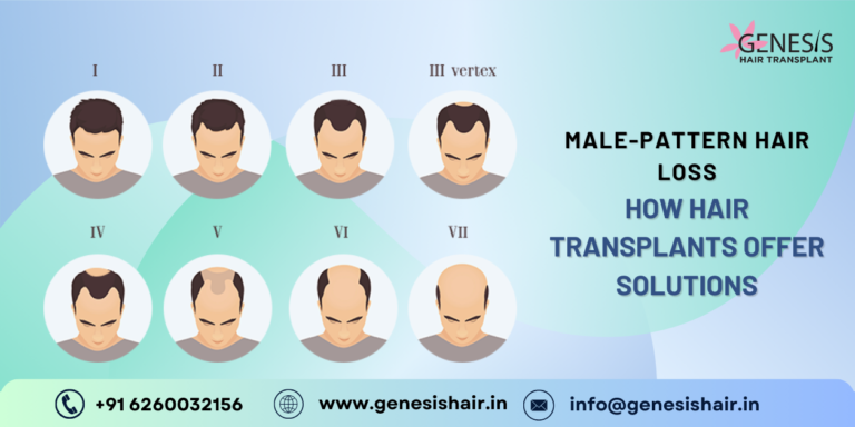 male pattern hair loss and hair transplant solutions