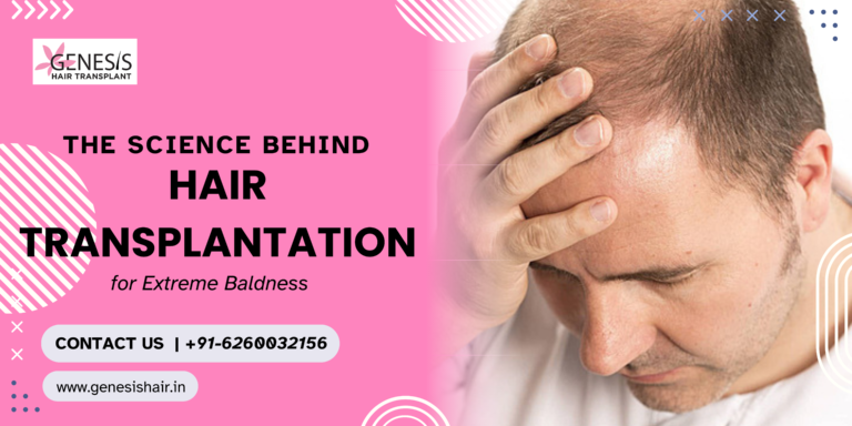 hair transplant in indore